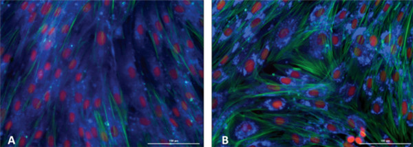 U-18666A改变了成纤维细胞中胆固醇的定位.jpg